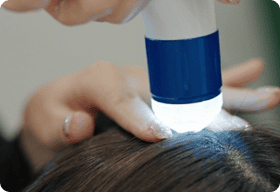 Scalp Diagnosis
