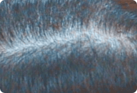 Follicle Activity