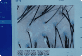 Scalp Type Diagnosis
