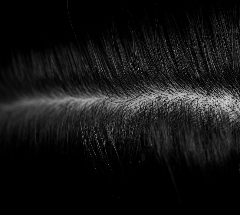 Great Hair Starts At The Scalp